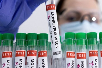 EU cho phép sử dụng vaccine Imvanex trong việc phòng chống bệnh đậu mùa khỉ