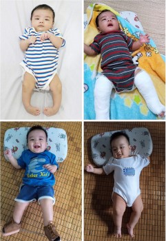 zhi shan ho tro phau thuat va dieu tri cho 49 tre em khuyet tat nghe an ha tinh thua thien hue