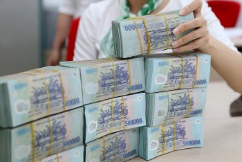 he lo loi nhuan quy 1 cua nhieu nha bang