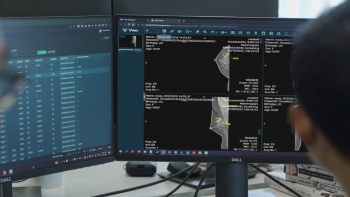 dat chuan fda khat khe san pham ai cua vinbigdata rong cua kinh doanh tren toan cau