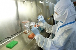 jica ho tro vien pasteurs goi sinh pham tri gia 4 trieu yen chong covid 19