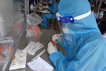 ngay 91 ca nuoc ghi nhan 15779 ca mac covid 19 moi