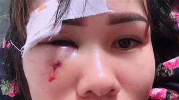 Thông tin xã hội sáng 9/9: Chủ tịch Hội Cựu chiến binh đấm rách mặt một phụ nữ