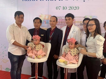 84 ngay sau ky tich phau thuat tach roi song nhi da duoc xuat vien