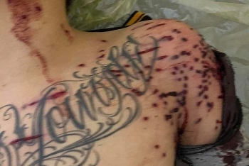 thong tin phap luat sang 2411 nam thanh nien nga guc o tram thu phi voi chi chit vet dan tren nguoi