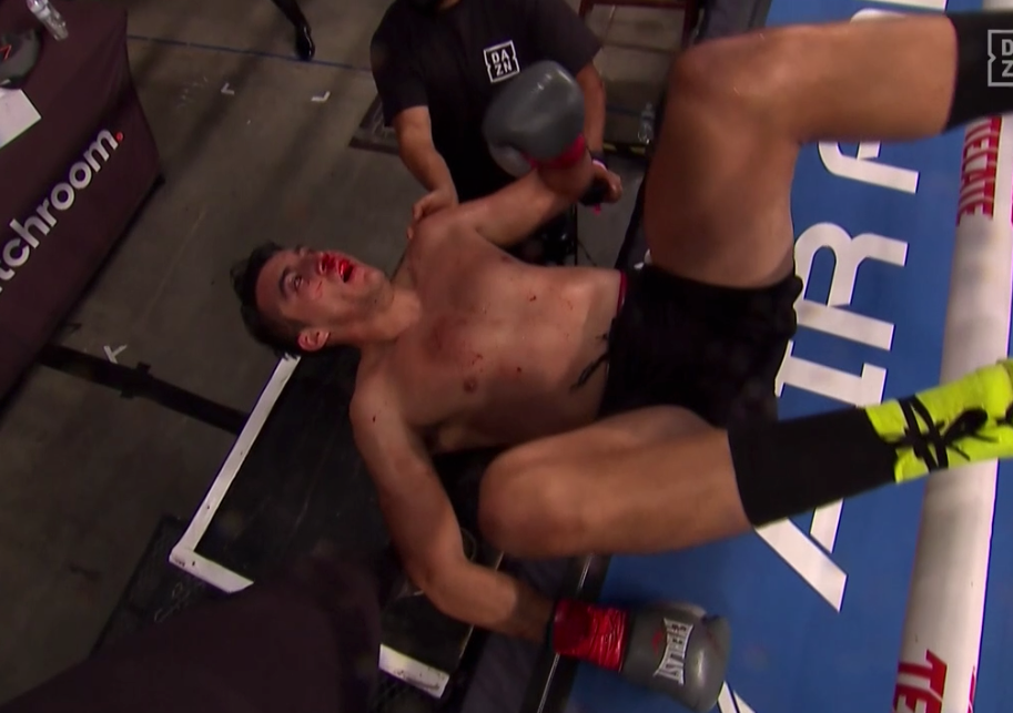 video goi don truoc doi thu vo si bi dam bay khoi san dau