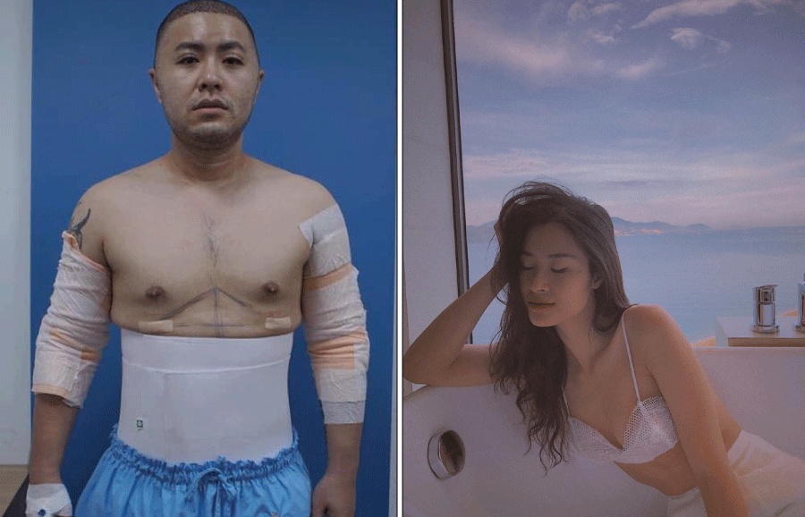 Facebook sao Việt hôm nay (15/6): Akira Phan phẫu thuật thẩm mỹ sau khi bị chê, Đông Nhi khoe sắc quyến rũ