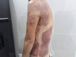 nhac nho chuyen dau o to nguoi phu nu bi hat chao dau soi vao nguoi o tphcm