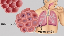 Viêm phổi do virus lạ ở Trung Quốc: Bộ Y tế khuyến cáo cách phòng, chống lây nhiễm