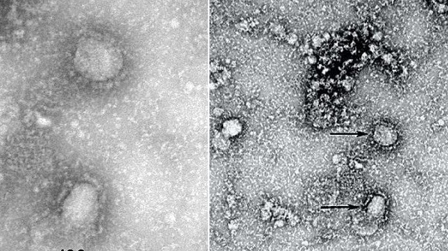 can canh virus corona moi khien ca the gioi lo ngai