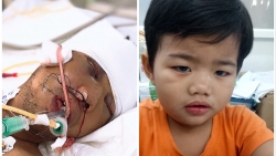 tp hcm tim nguoi than cho be trai 3 tuoi va bo bi tai nan giao thong nghiem trong