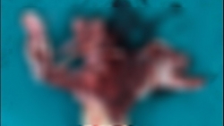 vua sac dien thoai vua dung thanh nien bi no nat ban tay