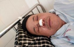 truy duoi 2 doi tuong trom cho truong cong an xa bi cau tac nem gay mui