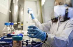 my bat dau thu nghiem lam sang vac xin ngua covid 19