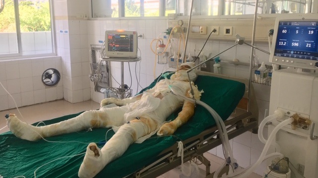 Nghi phạm tẩm xăng đốt cả nhà người tình ở Sơn La đã tử vong