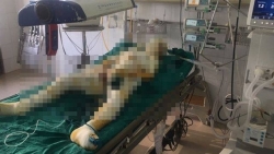 vu thieu song ca nha nguoi tinh o son la them nan nhan tu vong