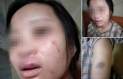 thai phu 8 thang bi chong danh bam dap vi mua do online