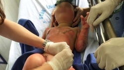 vu 3 tre mam non bi bong con nha truong tat het camera