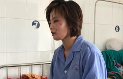 nhom thanh nien danh nu nhan vien xe buyt nhap vien da bo tron khoi dia phuong