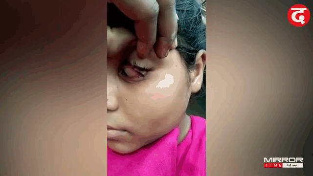 video ky la thieu nu 15 tuoi khoc ra da suot 2 thang
