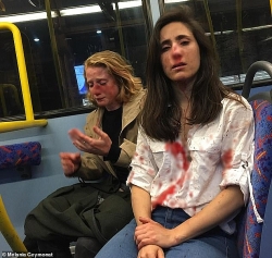 Hai cô gái đồng tính bị đánh đập dã man vì từ chối hôn nhau trên xe buýt