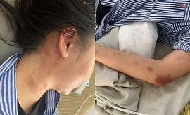 tin moi vu co gai bi ga trai xam tro danh dap da man o yen bai