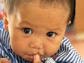 operation smile vietnam da phau thuat tai tao nu cuoi cho 638 tre em
