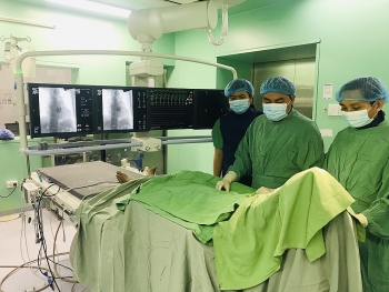 can tho nguoi phu nu 54 tuoi dot quy nao khi dang ngu benh vien huy dong 2 e kip cap cuu kip thoi