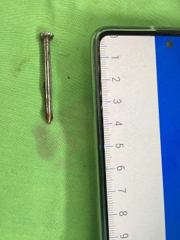 can tho phau thuat cuu song benh nhan tu dong dinh vao dau