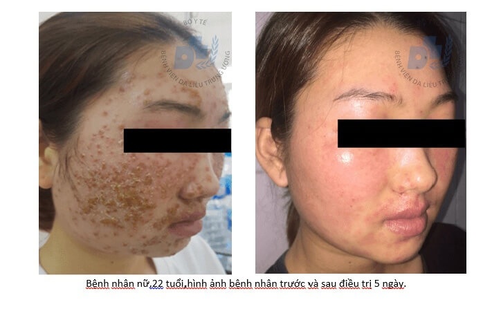Sử dụng mỹ phẩm trôi nổi trên mạng: Tiền mất, tật mang