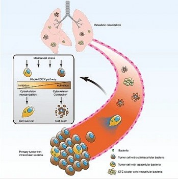 Vi khuẩn - Tác nhân khiến tế bào ung thư di căn