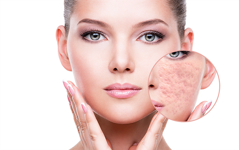 dich vu dieu tri seo ro tan goc tai seoul spa co uu diem gi
