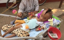 be trai dang thuong bi nut doi dau ma khong ro nguyen do