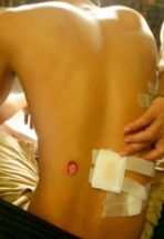 csgt ban dan cao su vao dan chi bi xu ly nhe