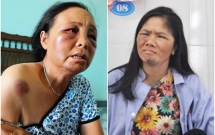 cong an trieu tap nhieu nguoi hanh hung 2 nguoi phu nu ban tam vi nghi bat coc tre em