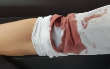 tphcm dieu tra vu mot phong vien dang tac nghiep bi doi tuong la mat dung xe dam roi lao xuong hanh hung