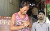 vu danh ghen tat axit kinh hoang va nguyen vong xin doi mat cua tu tu nguyen huu tinh