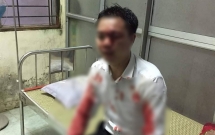 nhan vien hang xe mazda bi nhom doi tuong trum ao mua hanh hung da man giua duong