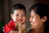 Operation Smile Vietnam sẽ phẫu thuật miễn phí cho khoảng 120 trẻ dị tật môi, hàm ếch tại Hải Phòng trong tháng 8