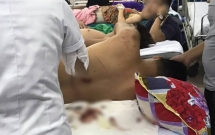 ha tinh truy tim nhom con do xong vao quan an chem loan xa khien mot nam thanh nien phai nhap vien cap cuu