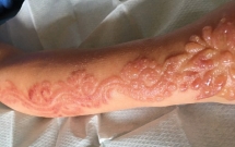 xam henna o tay trong chuyen du lich ai cap be gai nhan hau qua khung khiep