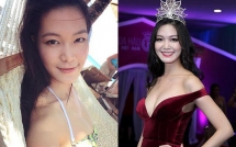 mat moc va ve goi cam cua hoa hau viet nam tuyen bo khong phau thuat tham my