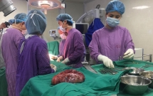 phau thuat cat bo thanh cong khoi u vu khong lo cho benh nhan o phu tho