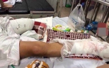 vu thanh nien bi truy sat chem nat chan nghi do mau thuan trong hoat dong cho vay tin dung den