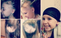 toc con vuong day luoc khi chai me nghi ngo can benh nay va day la chan doan chinh xac cua bac si