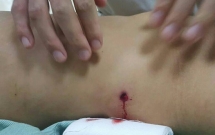 vu hai nhom no sung hon chien trong dem tren pho ha noi mot co gai bi dan xuyen thung dai trang thoat chet trong gang tac