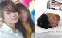 thuong tam thieu nu 17 tuoi bi tat axit huy hoai dung nhan tren duong tan ca lam tro ve