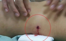 vu hai nhom no sung hon chien khien co gai thung dai trang tai ha noi cong an trieu tap mot so doi tuong