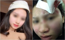 ha noi nguoi vo xinh dep to bi chong danh rach dau mang bau cung hanh hung khong tha