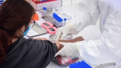 26 ca duong tinh khi test nhanh khong nhiem covid 19